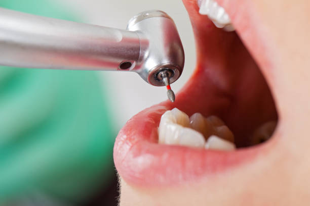 Best Emergency Gum Pain Relief  in South Boston, VA